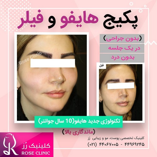 عکس هایفوتراپی 