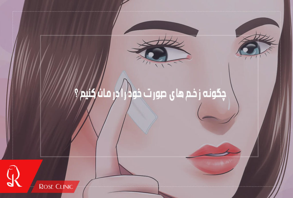 چگونه زخم های صورت خود را درمان کنیم