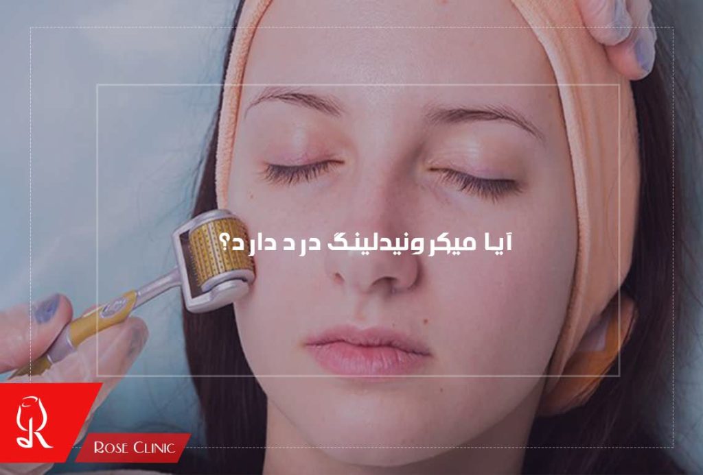 آیا میکرونیدلینگ درد دارد؟