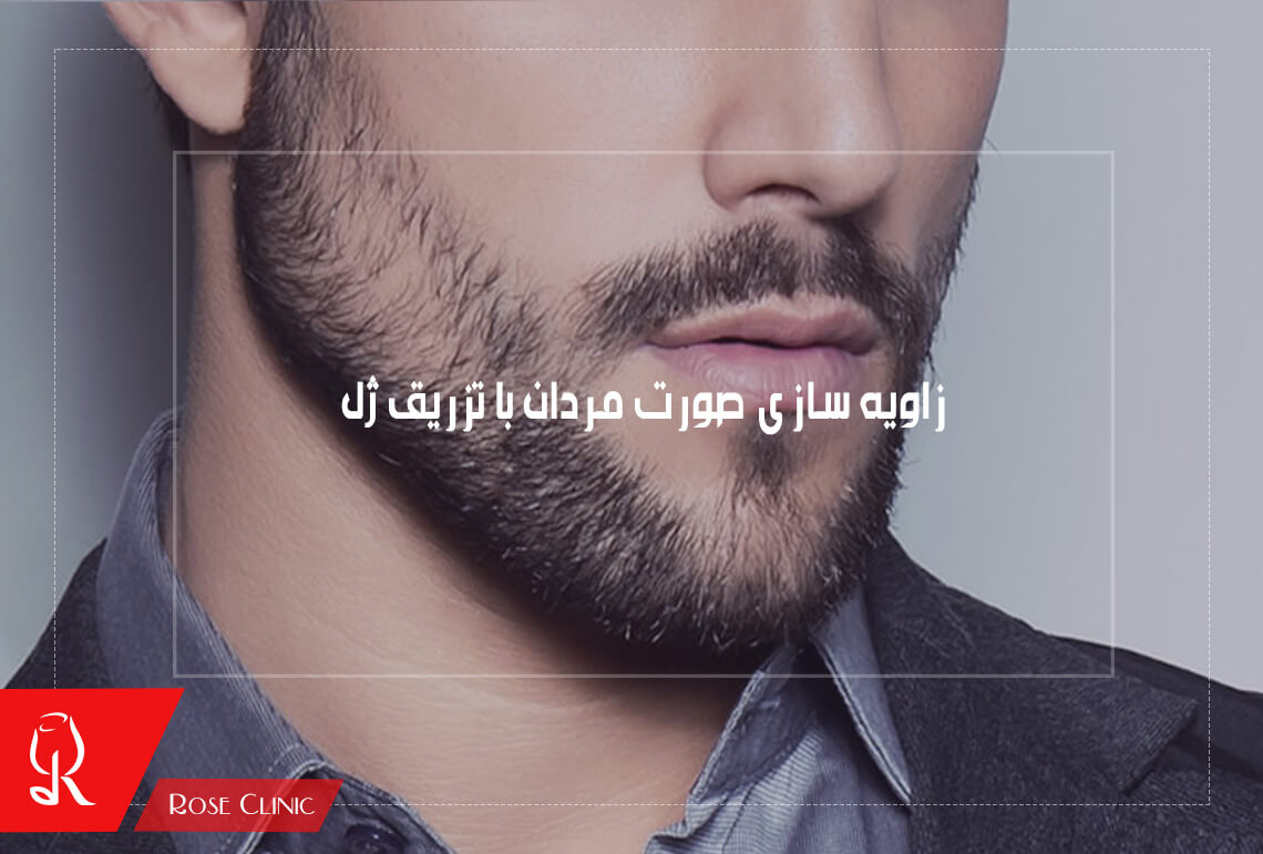 زاویه سازی صورت مردان با تزریق ژل