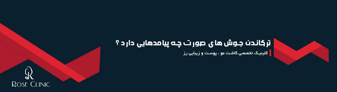 ترکاندن جوش های صورت چه پیامدهایی دارد ؟