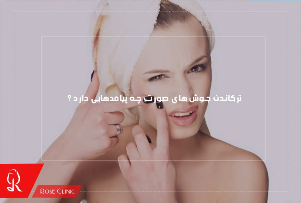 ترکاندن جوش های صورت چه پیامدهایی دارد ؟