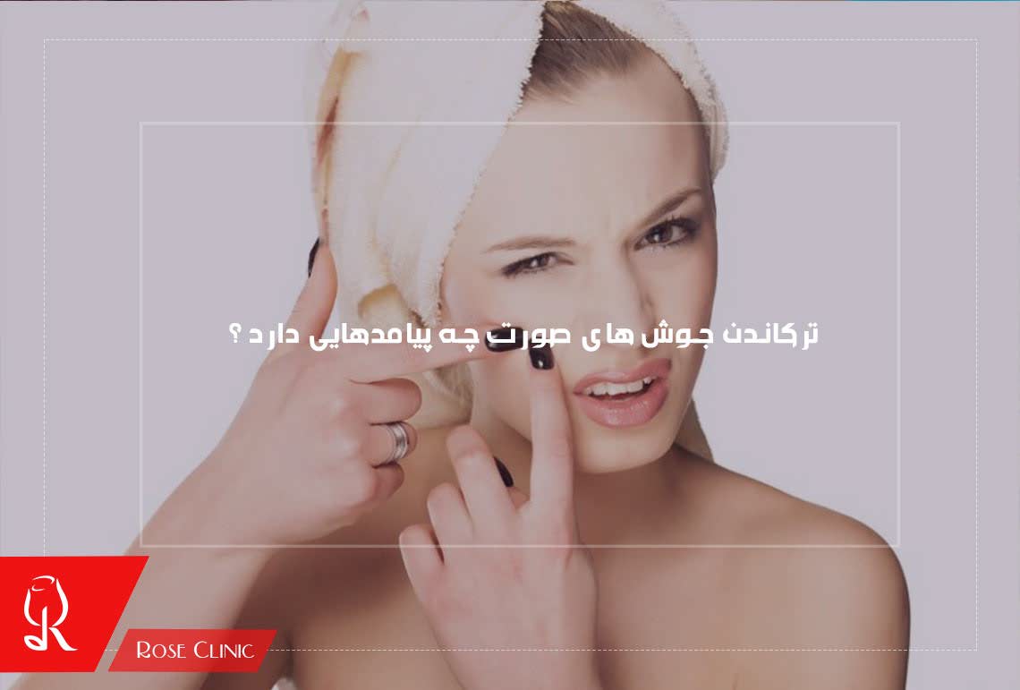 ترکاندن جوش های صورت چه پیامدهایی دارد ؟