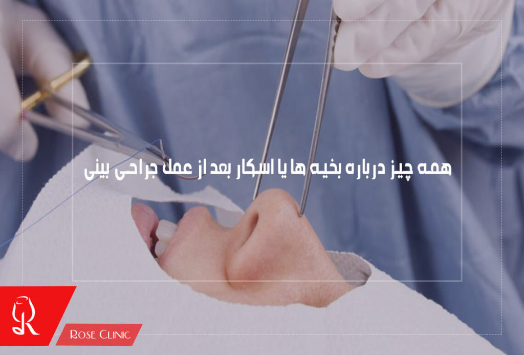 همه چیز درباره بخیه ها یا اسکار بعد از عمل جراحی بینی