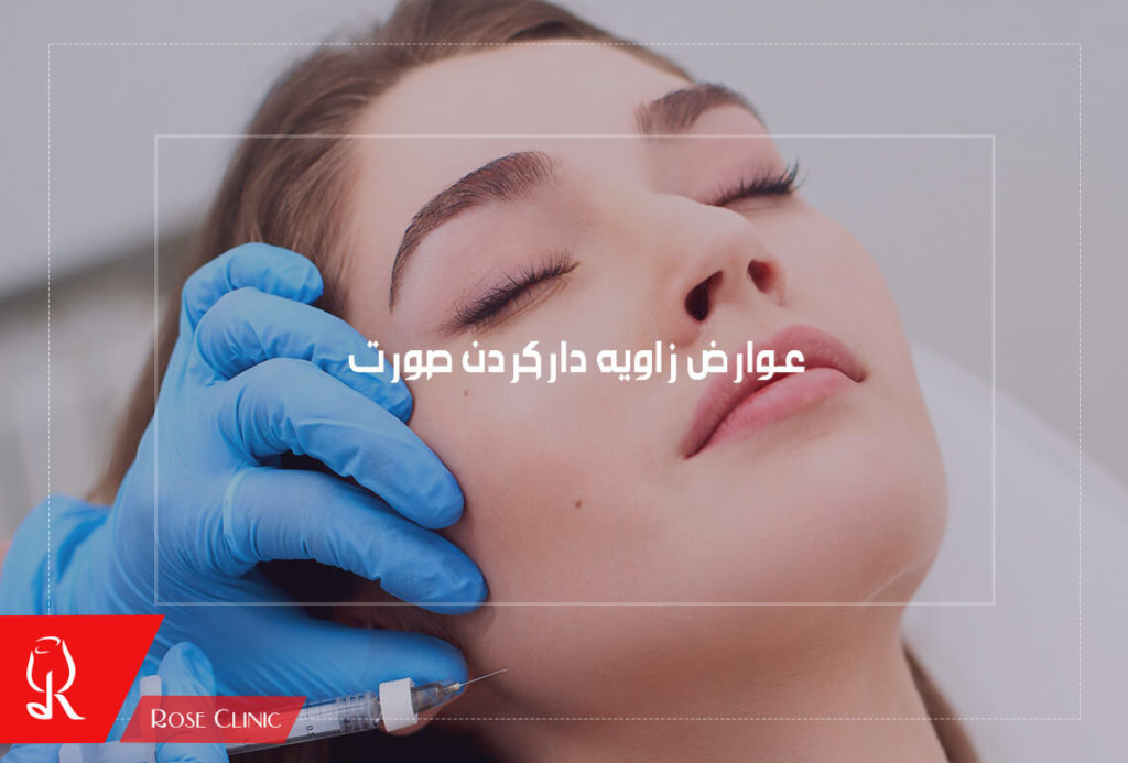 عوارض زاویه دارکردن صورت