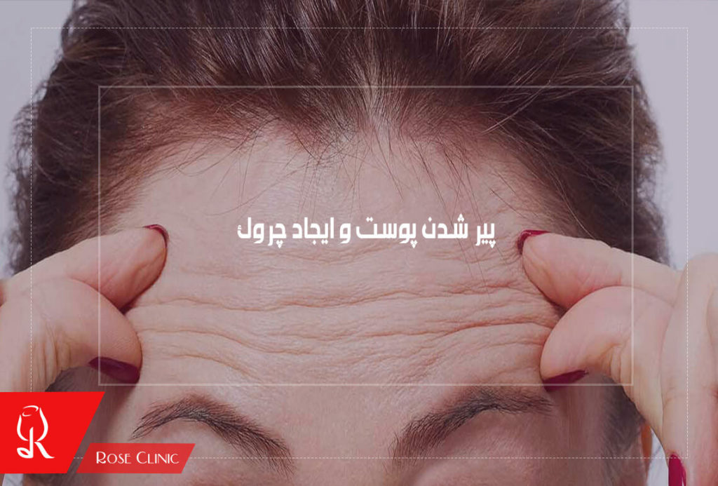 پیر شدن پوست و ایجاد چروک