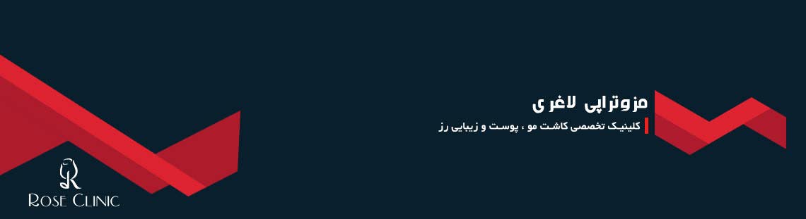 مزوتراپی لاغری