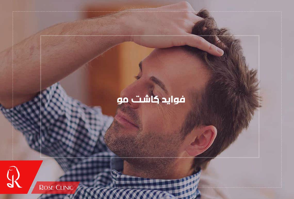 فواید کاشت مو