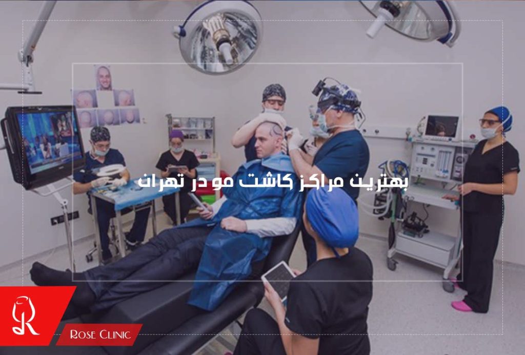 بهترین مراکز کاشت مو در تهران