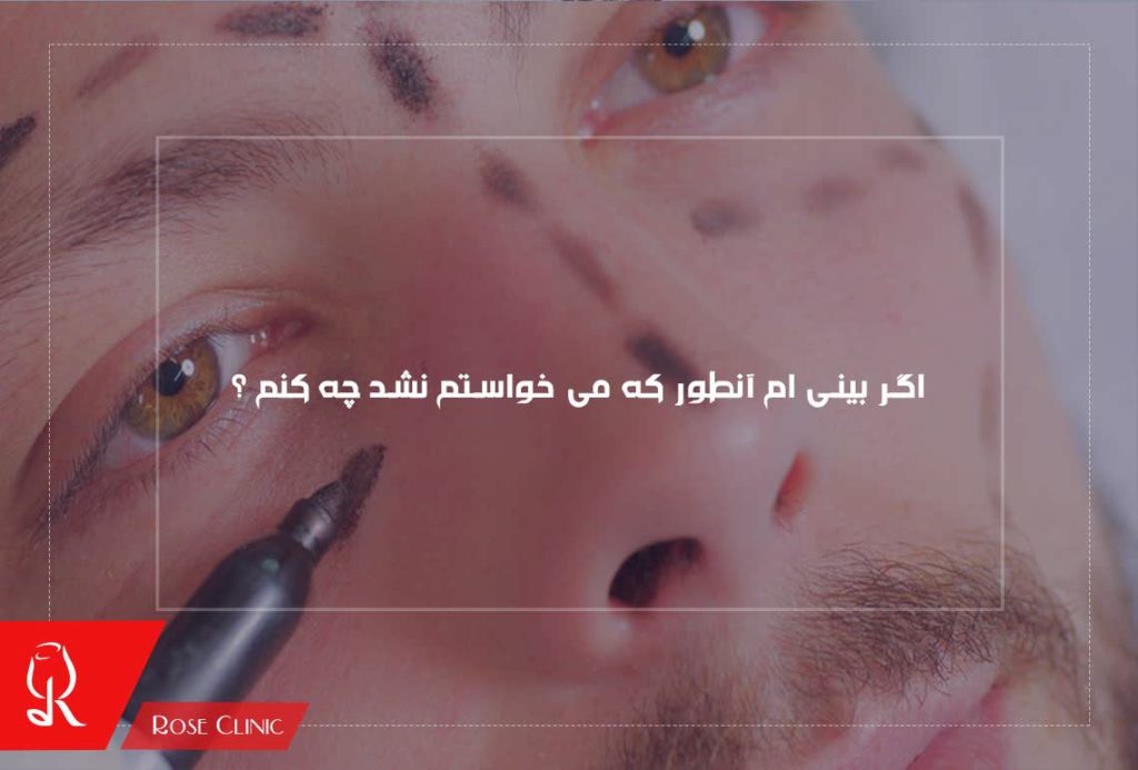 اگر بینی ام آنطور که می خواستم نشد چه کنم ؟