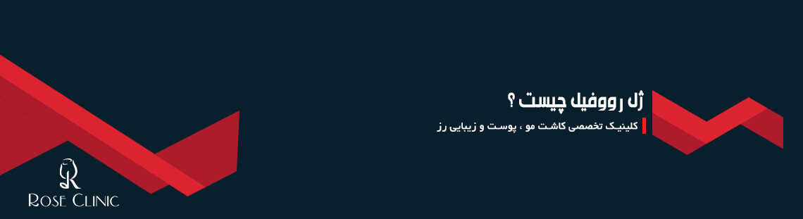 ژل رووفیل چیست ؟