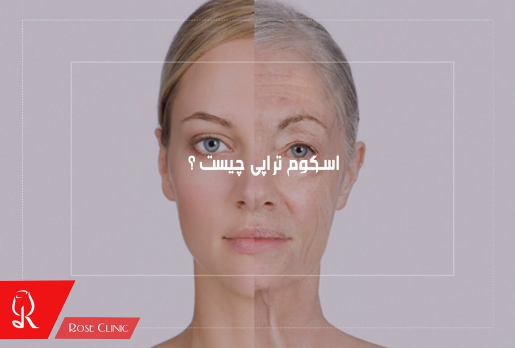 اسکوم تراپی چیست ؟