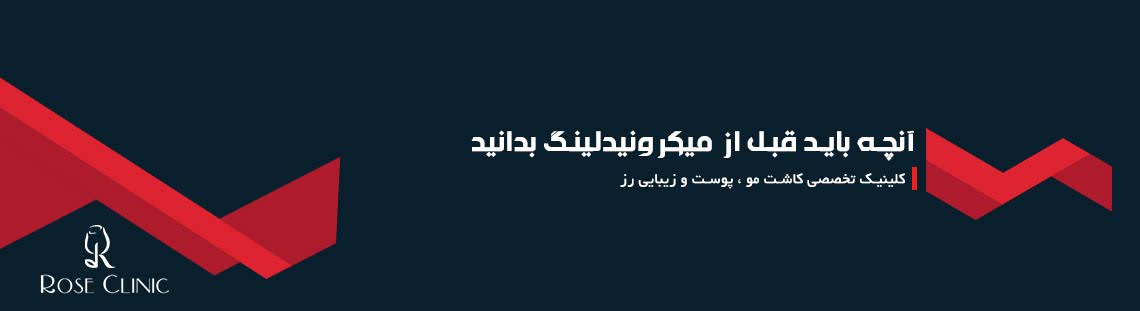 آنچه باید قبل از میکرونیدلینگ بدانید