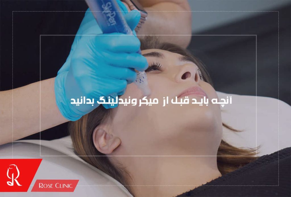 آنچه باید قبل از میکرونیدلینگ بدانید