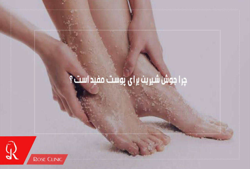 چرا جوش شیرین برای پوست مفید است