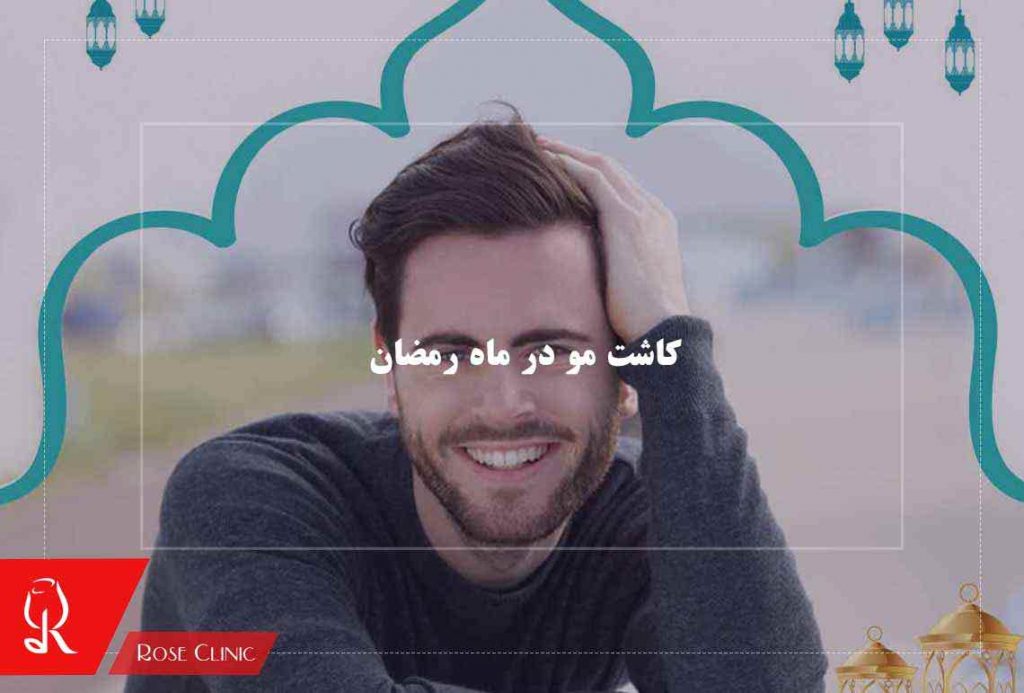 کاشت مو در ماه رمضان