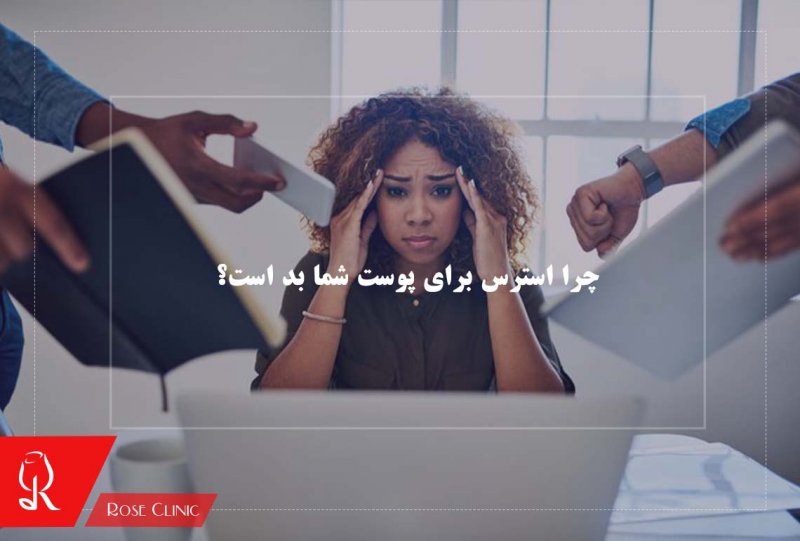 چرا استرس برای پوست شما بد است؟
