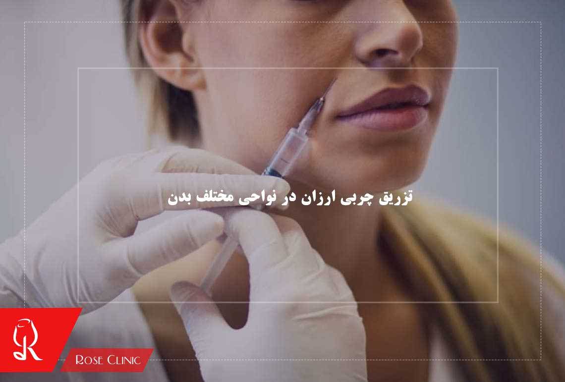 تزریق چربی ارزان در نواحی مختلف بدن