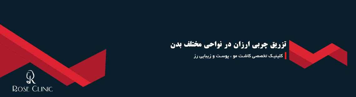 تزریق چربی ارزان در نواحی مختلف بدن