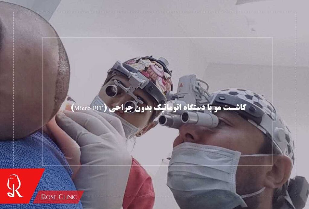 کاشت مو با دستگاه اتوماتیک بدون جراحی (Micro FIT)