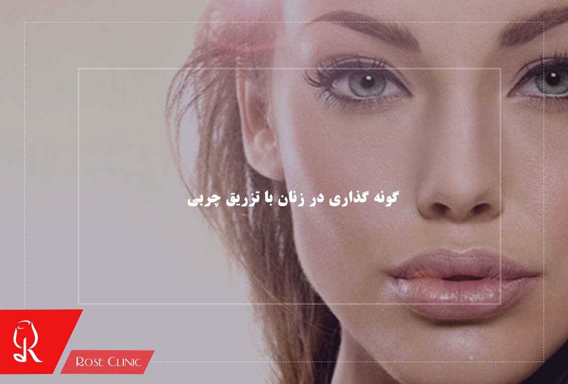 گونه گذاری در زنان با تزریق چربی