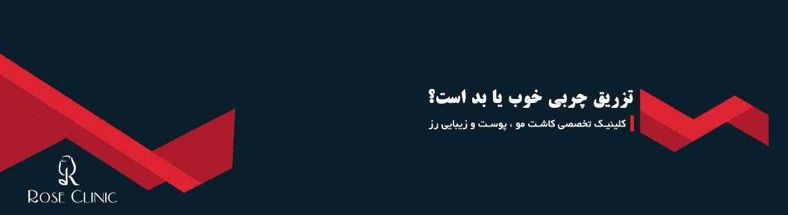 تزریق چربی خوب یا بد است؟