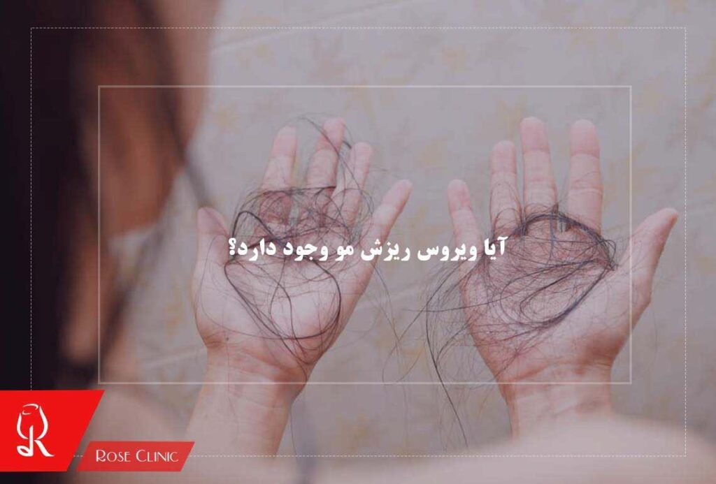 آیا ویروس ریزش مو وجود دارد؟