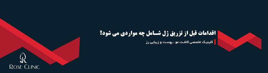 اقدامات قبل از تزریق ژل