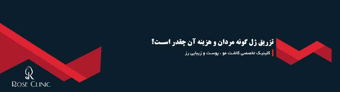 تزریق ژل گونه مردان