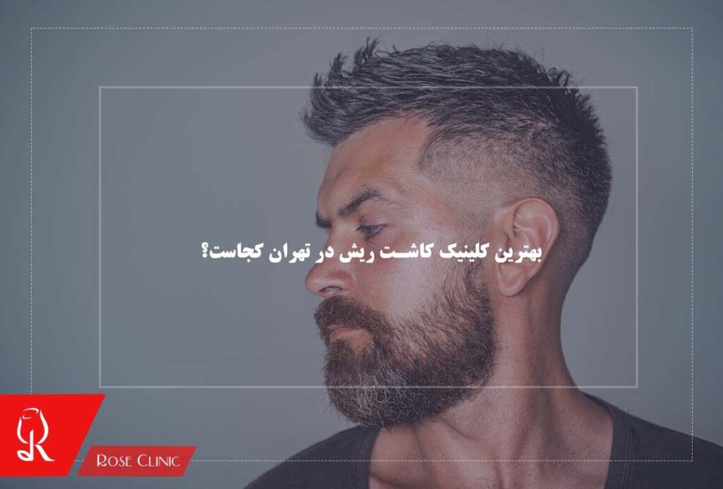 بهترین کلینیک کاشت ریش در تهران