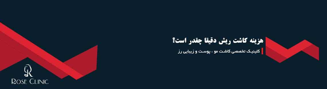 هزینه کاشت ریش