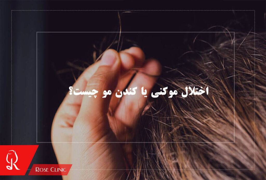 اختلال موکنی یا کندن مو چیست؟