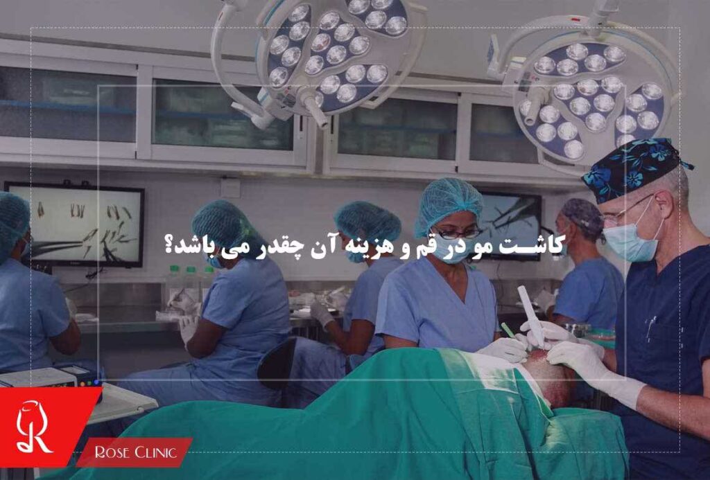 کاشت مو در قم و هزینه آن چقدر می باشد؟