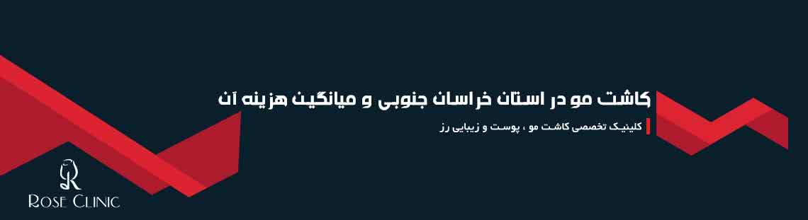 کاشت مو در استان خراسان جنوبی و میانگین هزینه آن