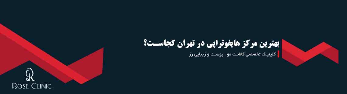 بهترین مرکز هایفوتراپی در تهران کجاست؟