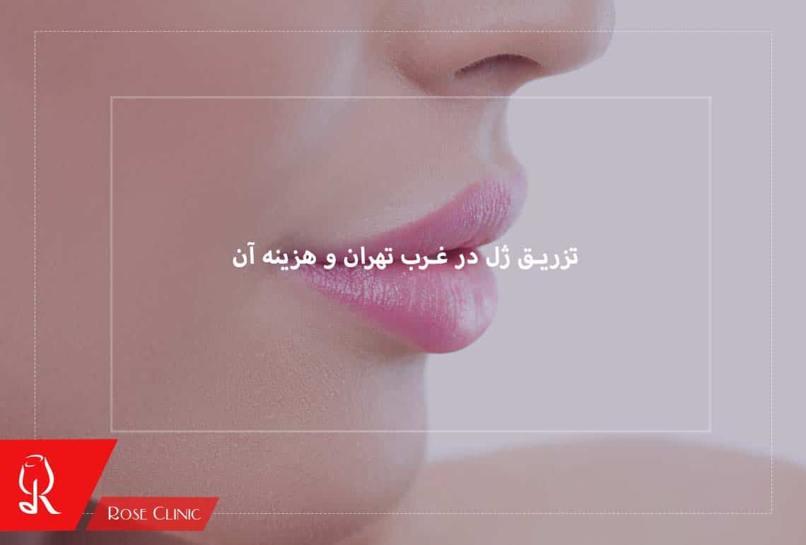 تزریق ژل در غرب تهران و هزینه آن 