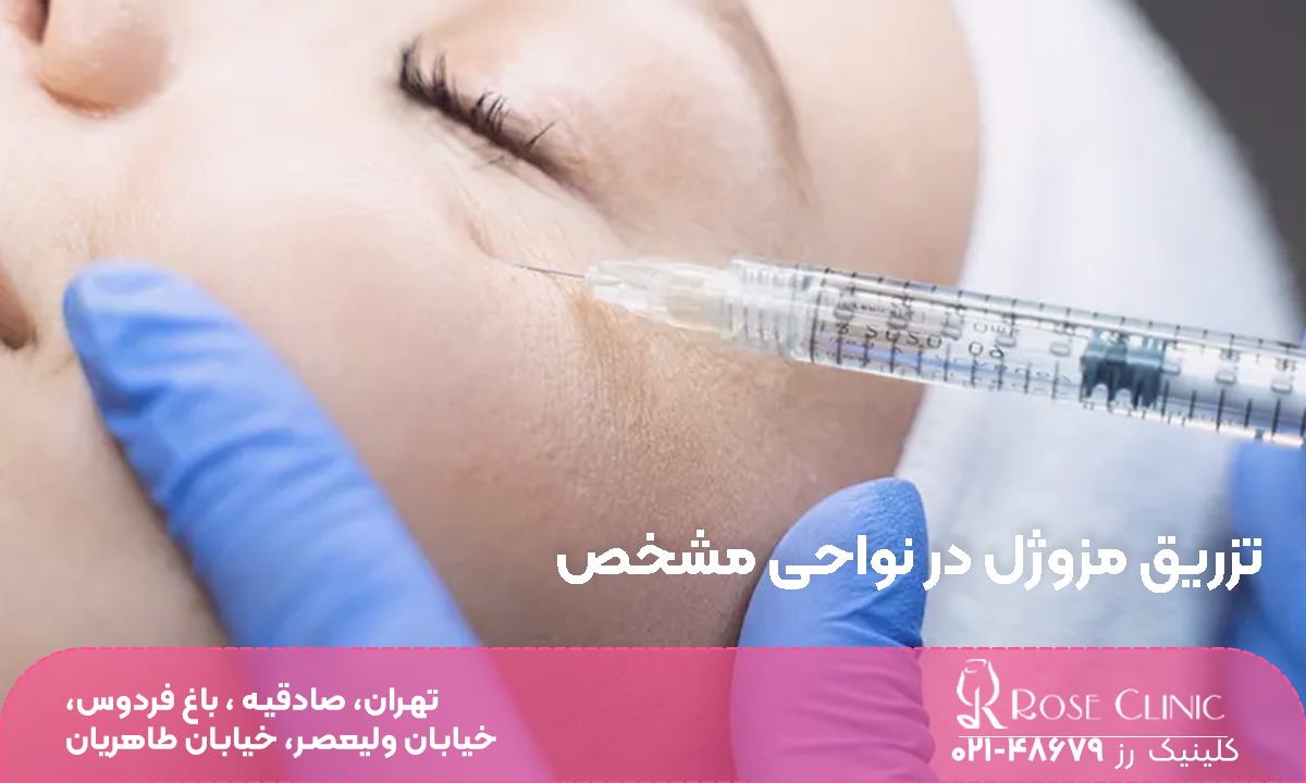 فردی که خوابیده است و دست دکتری که در حال تزریق مزوژل زیر چشم او است