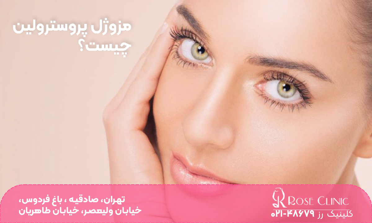 دختری که دستش زیر چانه اش است و کمی سرش کج است و به سمت بالا نگاه میکند