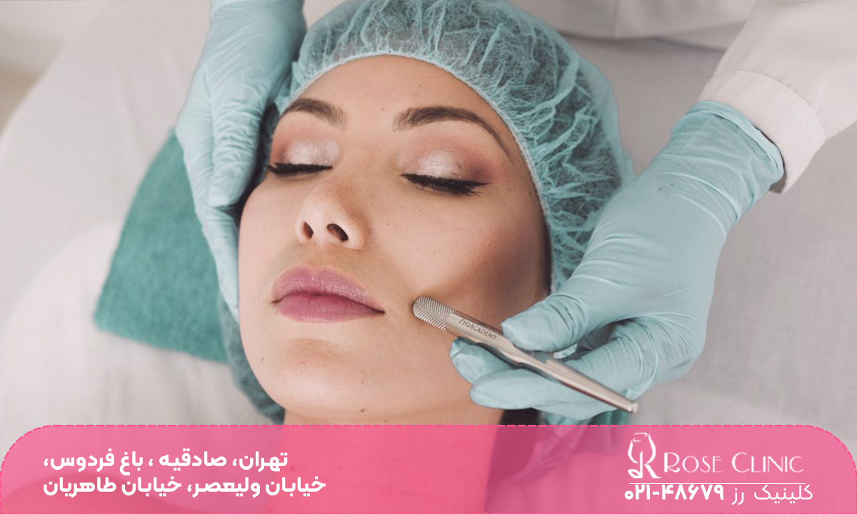 دختری که چشم خود را بسته و کلاه به سر دارد و فردی که خط لبخند او را مزوتراپی می کند