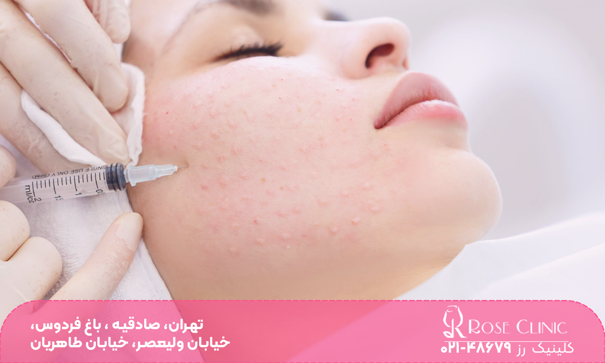 دختری که پزشک به صورت او مزوژل تزریق می کند و نقاط متعدد تزریق روی صورت او متورم و قرمز شده است - مزوژل بلانک بی​