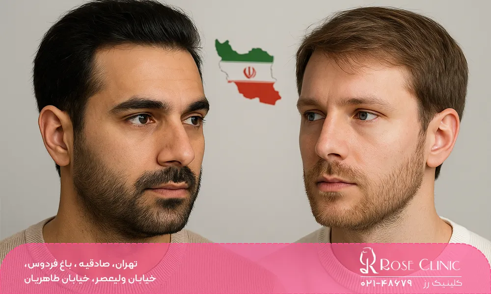 کاشت مو در ایران یا ترکیه