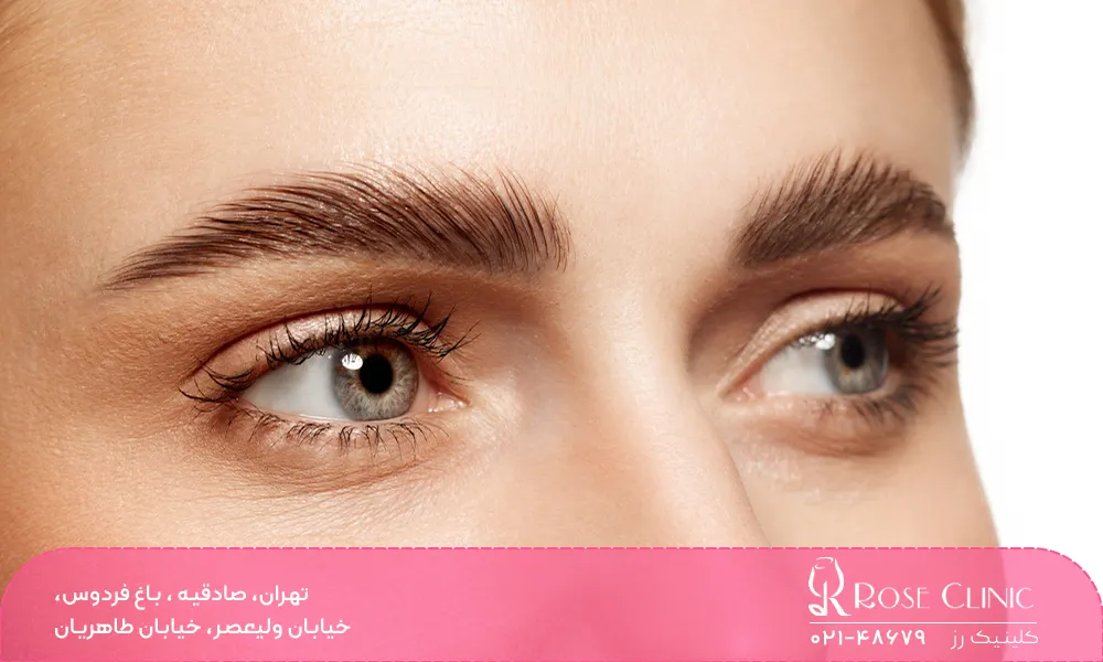 اصول کلی روش میکرو کاشت ابرو