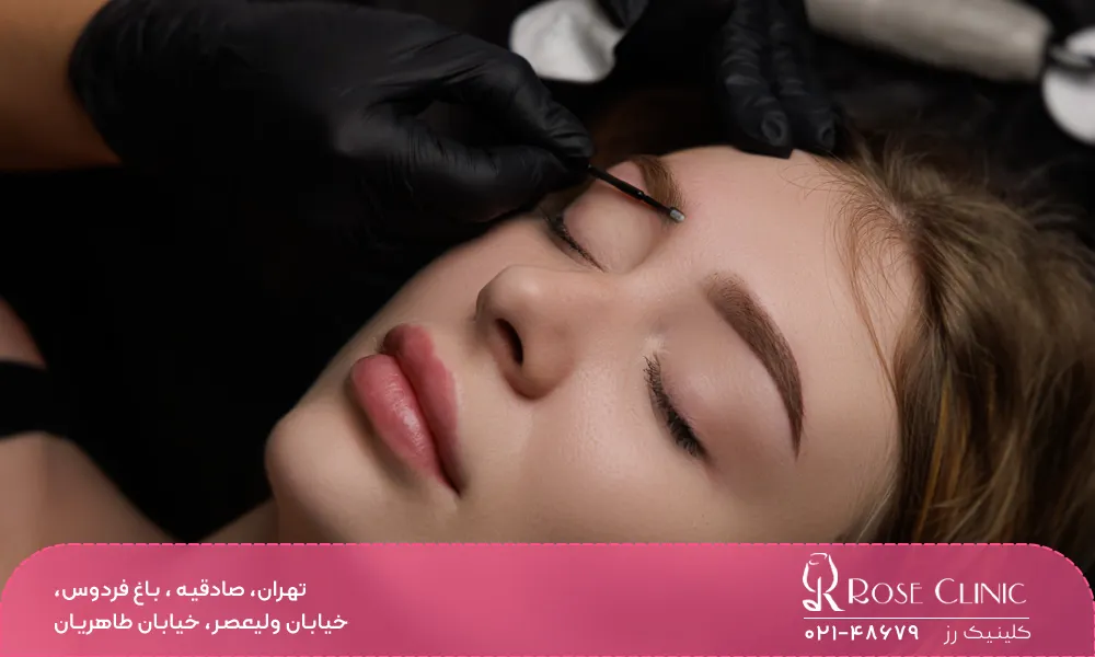 مزایا میکرو کاشت ابرو