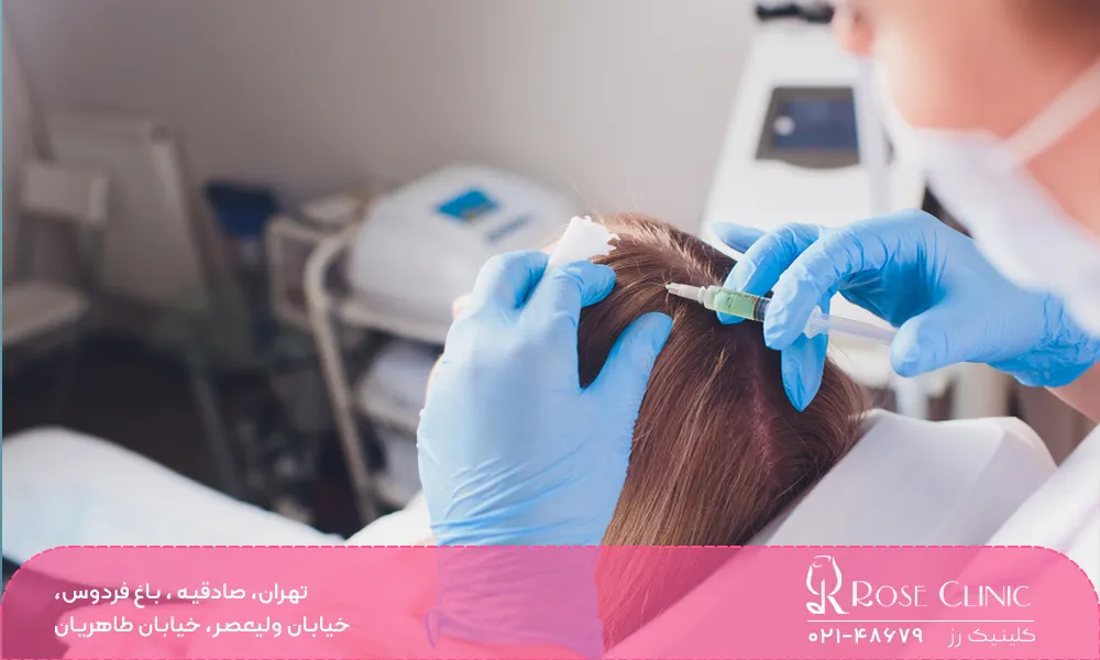 روش های کاشت مو مبتنی بر سلول های بنیادی