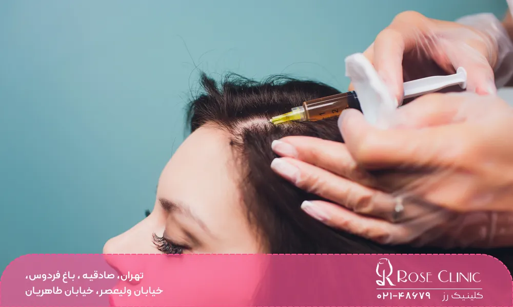 کاشت مو با سلول های بنیادی در کلینیک رز