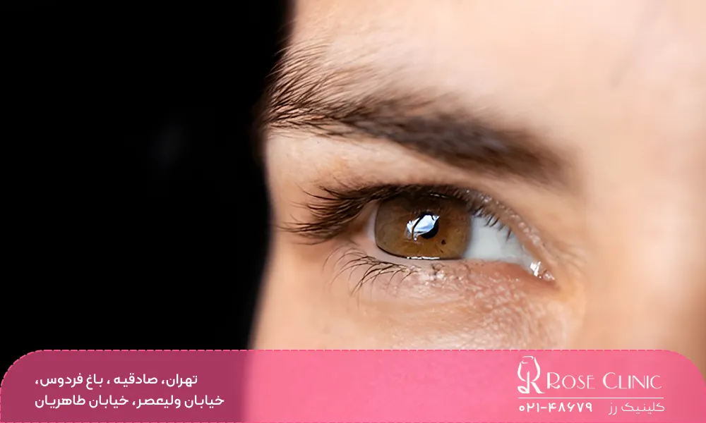 مراقبت های لازم پس از کاشت ابرو در فصول مختلف