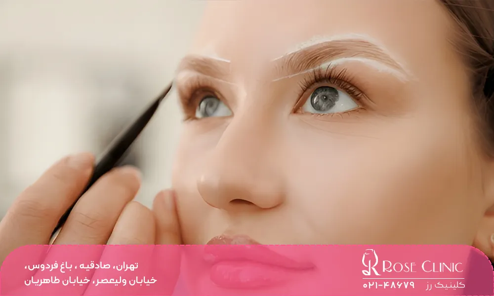 تأثیر جنس پوست بر نتیجه کاشت ابرو