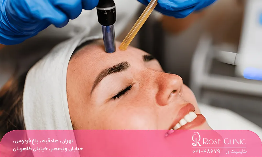 شستشوی صورت بعد از مزونیدلینگ