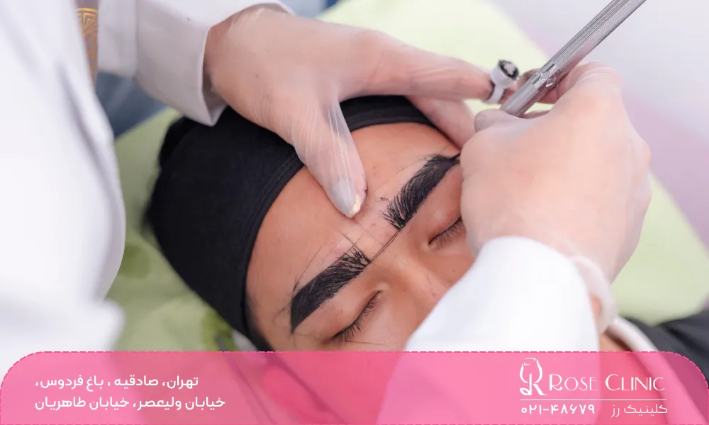 کاشت ابرو بهتر است یا میکروبلیدینگ؟