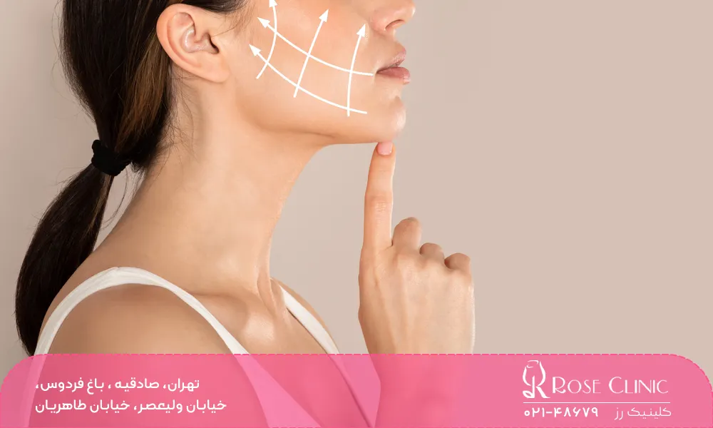 هزینه کانتورینگ